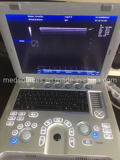 (MS-4500) Scanner portable pour ordinateur portable Full Digital 3D 4D Echo Color Doppler Ultrasound Scanner