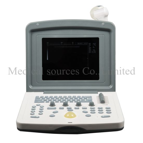 (MS-P800V) Scanner à ultrasons numérique pour ordinateur portable médical