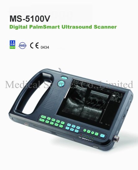 (MS-5100V) Scanner à ultrasons vétérinaire Doppler couleur Portbale pour chat